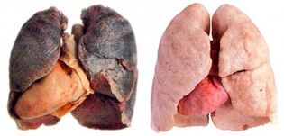белите дробове на пушача и здрави