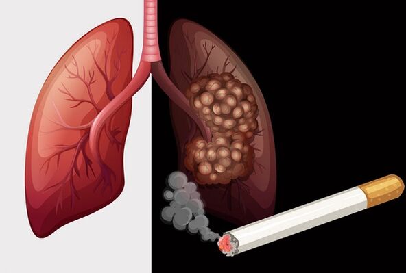 белите дробове на пушача и здравите бели дробове